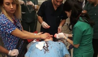 В Турции за последние пять лет зафиксировано 60 тыс. нападений на медицинских сотрудников   