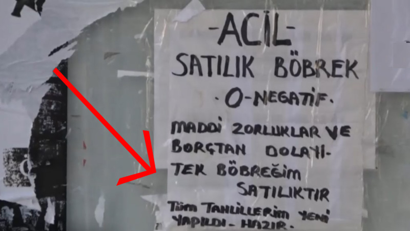 Объявление о продаже почки в Стамбуле!