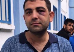 Мужчину, направлявшегося на футбольный матч, избили из-за его курдского происхождения   