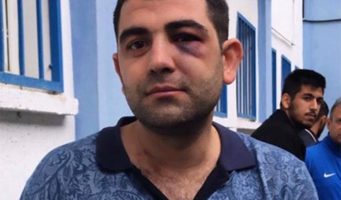 Мужчину, направлявшегося на футбольный матч, избили из-за его курдского происхождения   