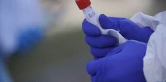 Турция занимает четвертое место в мире по смертности от коронавируса   