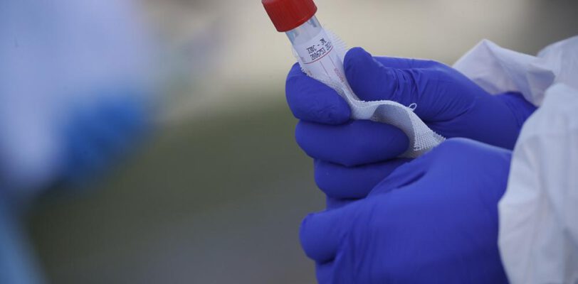 Турция занимает четвертое место в мире по смертности от коронавируса   