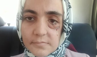 Издевательства над онкобольной Айше Оздоган: Институт судебной медицины Стамбула снова запросил подтверждение, что женщина больна раком